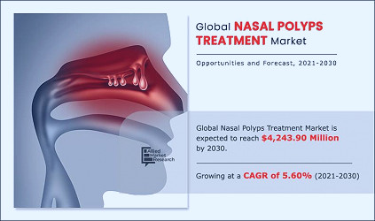 Nasal Polyps Treatment Market Size | Industry Growth, 2030